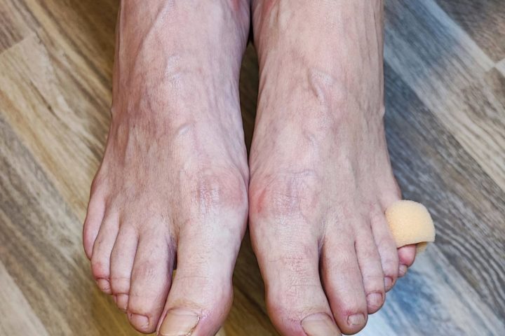 gepflegte Füße mit Druckschutz